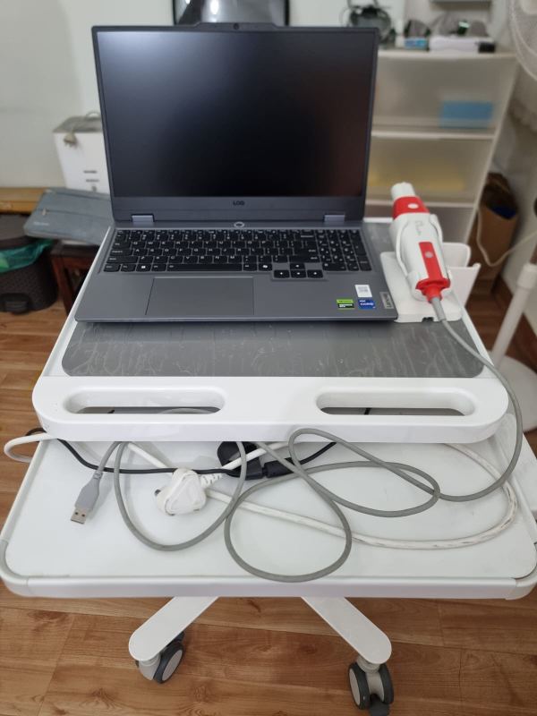 Intra-oral digital scanner